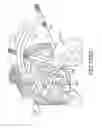 Fig. 151 - Methods of fusing a sacroiliac joint with an additively manufactured sacroiliac joint implant
