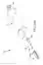 Fig. 154 - Methods of fusing a sacroiliac joint with an additively manufactured sacroiliac joint implant