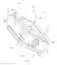 Fig. 191 - Methods of fusing a sacroiliac joint with an additively manufactured sacroiliac joint implant