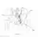 Fig. 216 - Methods of fusing a sacroiliac joint with an additively manufactured sacroiliac joint implant
