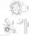Fig. 30 - Methods of fusing a sacroiliac joint with an additively manufactured sacroiliac joint implant