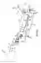 Fig. 43 - Methods of fusing a sacroiliac joint with an additively manufactured sacroiliac joint implant