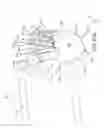 Fig. 53 - Methods of fusing a sacroiliac joint with an additively manufactured sacroiliac joint implant