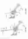 Fig. 56 - Methods of fusing a sacroiliac joint with an additively manufactured sacroiliac joint implant