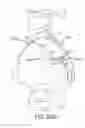 Fig. 69 - Methods of fusing a sacroiliac joint with an additively manufactured sacroiliac joint implant