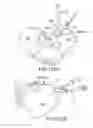 Fig. 83 - Methods of fusing a sacroiliac joint with an additively manufactured sacroiliac joint implant