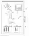 Fig. 86 - Methods of fusing a sacroiliac joint with an additively manufactured sacroiliac joint implant