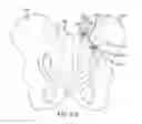 Fig. 89 - Methods of fusing a sacroiliac joint with an additively manufactured sacroiliac joint implant