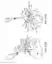 Fig. 90 - Methods of fusing a sacroiliac joint with an additively manufactured sacroiliac joint implant