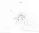 Fig. 04 - Hip joint device