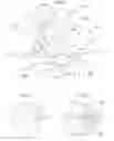 Fig. 08 - Hip joint device