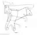 Fig. 05 - Total artificial spino-laminar prosthetic replacement