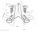 Fig. 12 - Total artificial spino-laminar prosthetic replacement