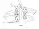 Fig. 14 - Total artificial spino-laminar prosthetic replacement