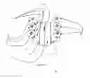 Fig. 15 - Total artificial spino-laminar prosthetic replacement