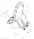 Fig. 18 - Total artificial spino-laminar prosthetic replacement