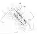 Fig. 20 - Total artificial spino-laminar prosthetic replacement