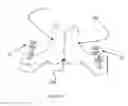 Fig. 28 - Total artificial spino-laminar prosthetic replacement