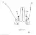 Fig. 33 - Total artificial spino-laminar prosthetic replacement
