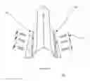 Fig. 35 - Total artificial spino-laminar prosthetic replacement