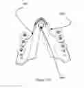 Fig. 38 - Total artificial spino-laminar prosthetic replacement