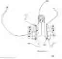 Fig. 41 - Total artificial spino-laminar prosthetic replacement