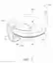 Fig. 02 - Prosthesis guide comprising patient-matched features