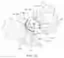 Fig. 22 - Prosthesis guide comprising patient-matched features