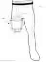 Fig. 01 - Above the knee post-operative residual limb support
