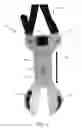 Fig. 05 - Above the knee post-operative residual limb support