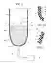 Fig. 02 - Prosthetic system for sweat management