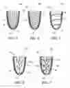 Fig. 03 - Prosthetic system for sweat management