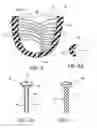 Fig. 04 - Prosthetic system for sweat management