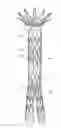Fig. 01 - ARTICULAR VASCULAR IMPLANTS USING POLYMAGNETS