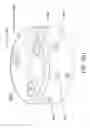 Fig. 41 - Intragastric device