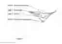 Fig. 02 - Disposable absorbent lift device