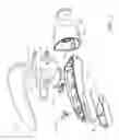 Fig. 02 - Lip enhancement device and method