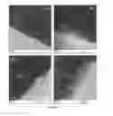 Fig. 18 - Multi-functional micro and nanoparticles for use in root canal therapies