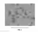 Fig. 09 - Bendamustine Solid Dispersions And Continuous Infusion