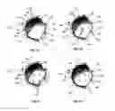 Fig. 02 - Methods and devices for treating a retinal detachment