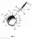 Fig. 03 - Methods and devices for treating a retinal detachment