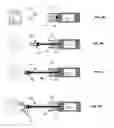 Fig. 05 - Methods and devices for treating a retinal detachment