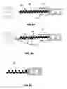 Fig. 06 - Methods and devices for treating a retinal detachment