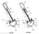 Fig. 07 - Methods and devices for treating a retinal detachment