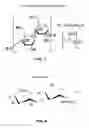 Fig. 08 - Methods and devices for treating a retinal detachment