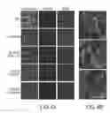 Fig. 05 - Compositions and methods for treating neurological diseases or injury