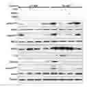 Fig. 01 - METHODS AND COMPOSITIONS FOR TREATING NEPHROPATHY