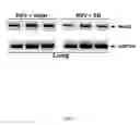 Fig. 07 - COMPOSITIONS AND METHODS FOR THE TREATMENT OF VIRAL INFECTION