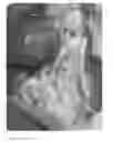 Fig. 01 - Kit for treating sepsis and/or any systemic (SIRS) or damaging cellular hyperinflammation