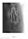 Fig. 09 - Pharmaceutical formulation